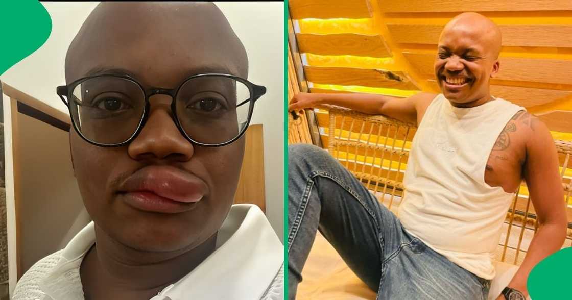 A man dared and faced his fruit seed allergy, leaving the internet in laughter. A man dared and faced his fruit seed allergy, leaving the internet in laughter.