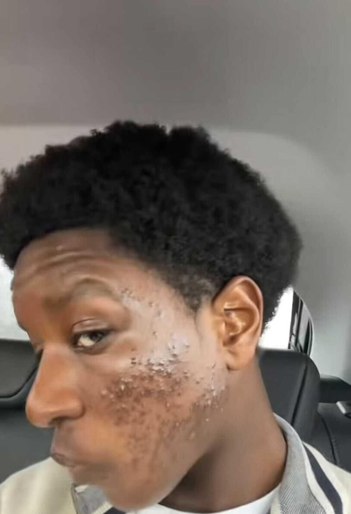 A man revealed his stunning skin glow-up in a viral TikTok video.