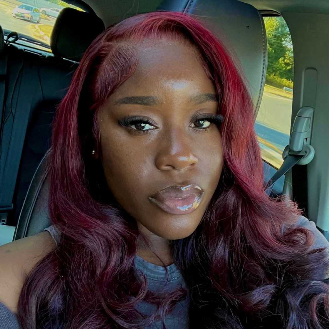 Social media users asked more questions after seeing a lady's hair growth plug Social media users asked more questions after seeing a lady's hair growth plug