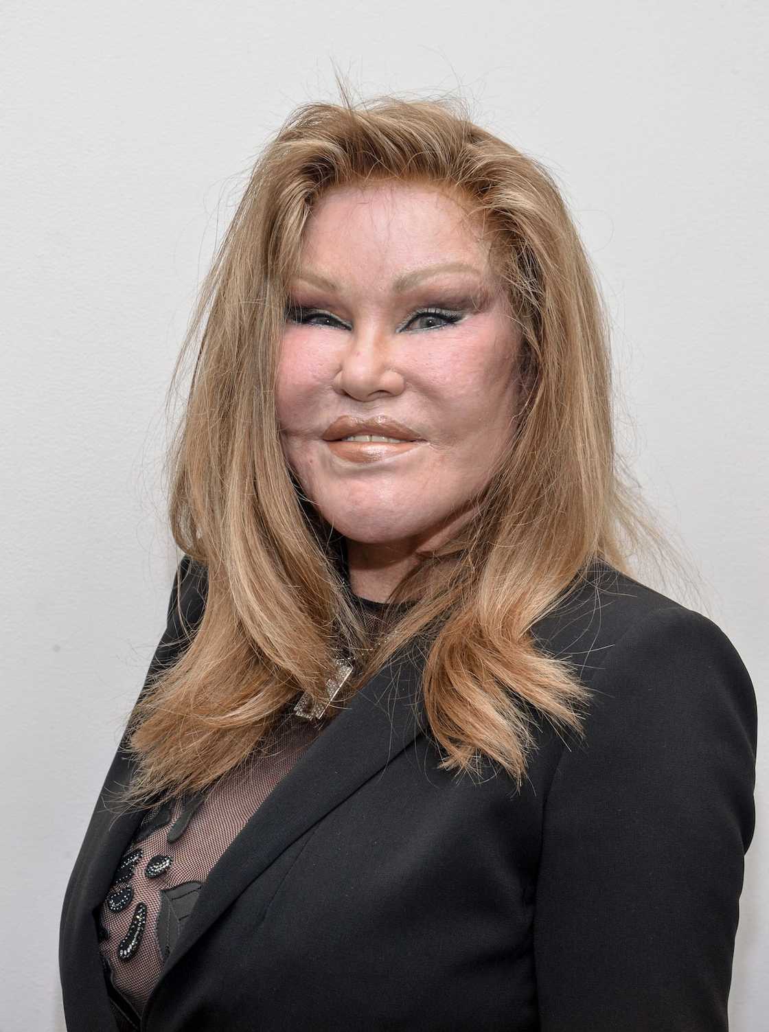 What happened to Jocelyn Wildenstein?