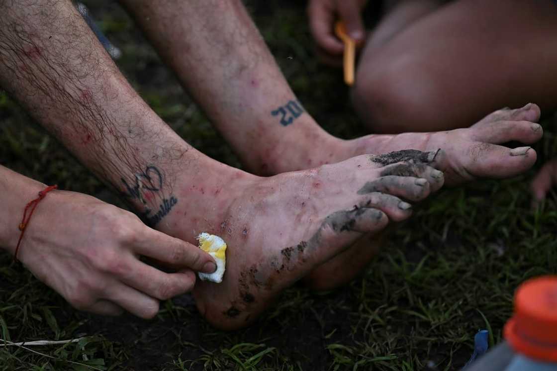 A man tends to his injuries at Canaan Membrillo village in Panama's Darien Jungle on October 12, 2022 A man tends to his injuries at Canaan Membrillo village in Panama's Darien Jungle on October 12, 2022