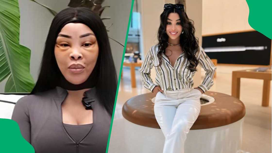 Khanyi Mbau's new face sparked controversy. Khanyi Mbau's new face sparked controversy.