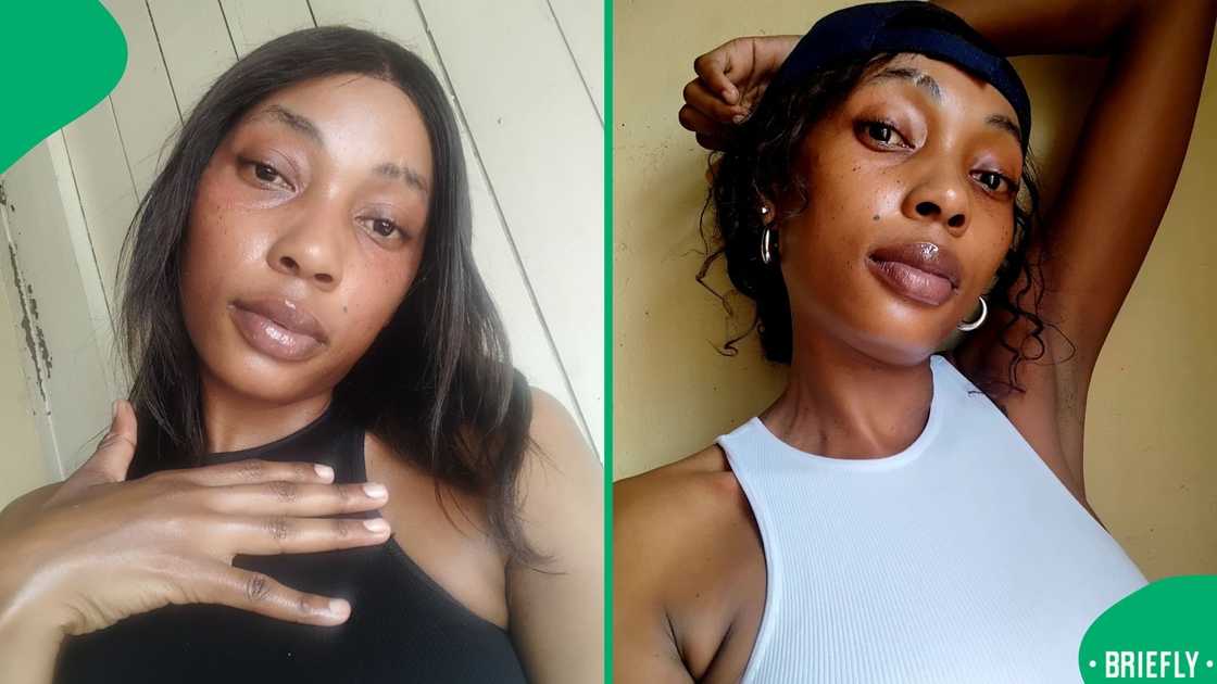 A Facebook video gained thousands of likes as she shared how bleaching damaged her skin and urged others to love their natural tone A Facebook video gained thousands of likes as she shared how bleaching damaged her skin and urged others to love their natural tone