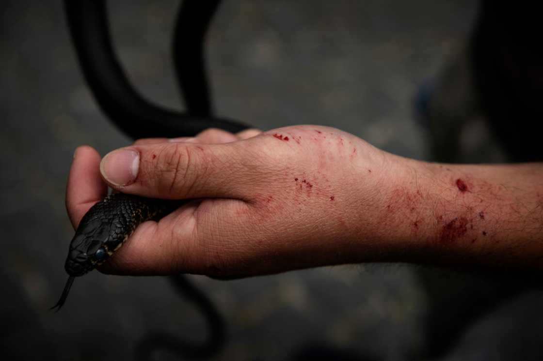 The stilleto snake's bite causes blistering The stilleto snake's bite causes blistering