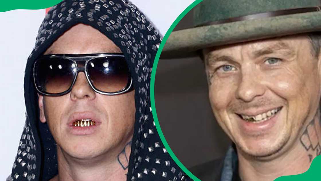 Sid Wilson's teeth have been enhanced with gold caps