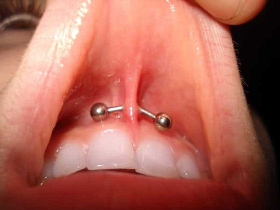 Does the smiley piercing hurt?