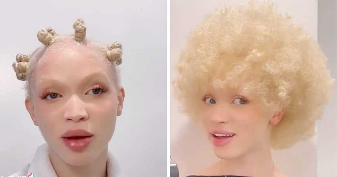 Model living with albinism rocks new hair-do Model living with albinism rocks new hair-do