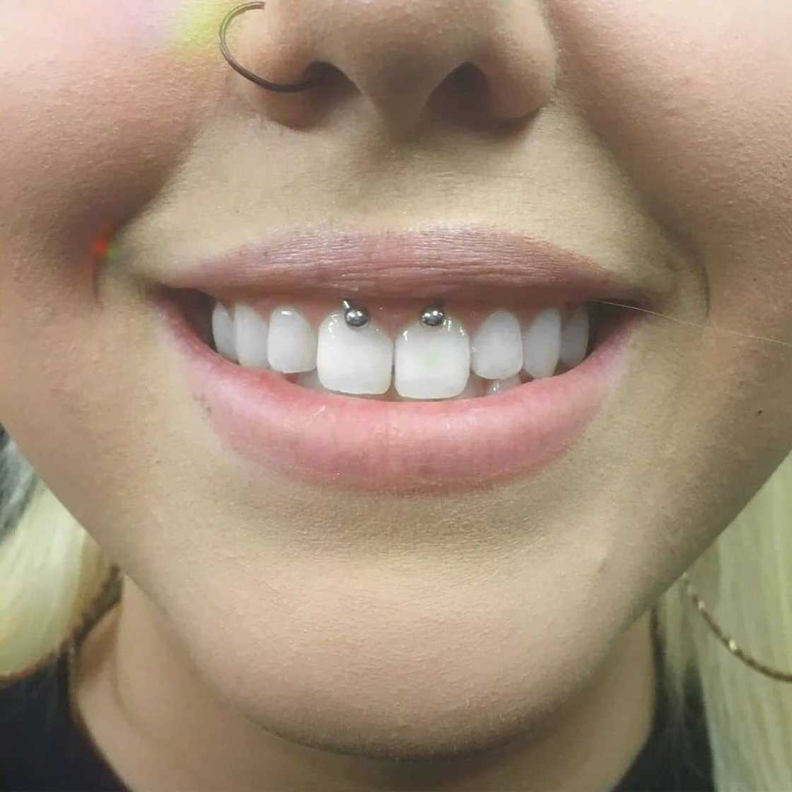 Are smiley piercings safe?