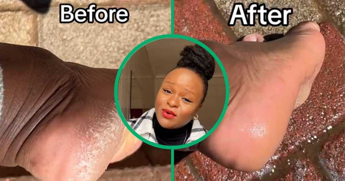 Woman's cracked heels Woman's cracked heels