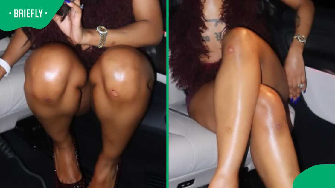 Bruises and scars on Uncle Waffles knees and legs