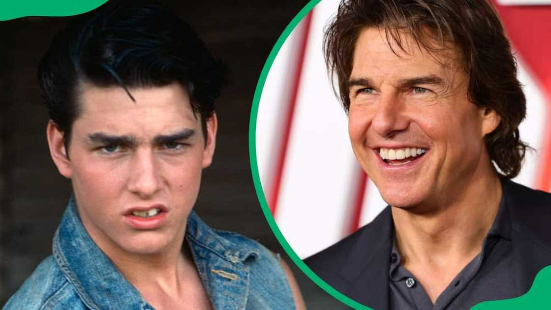 Tom Cruise’s teeth before and after Tom Cruise’s teeth before and after