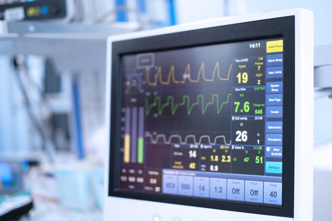 The screen of a ventilator monitoring in an operating room. The screen of a ventilator monitoring in an operating room.