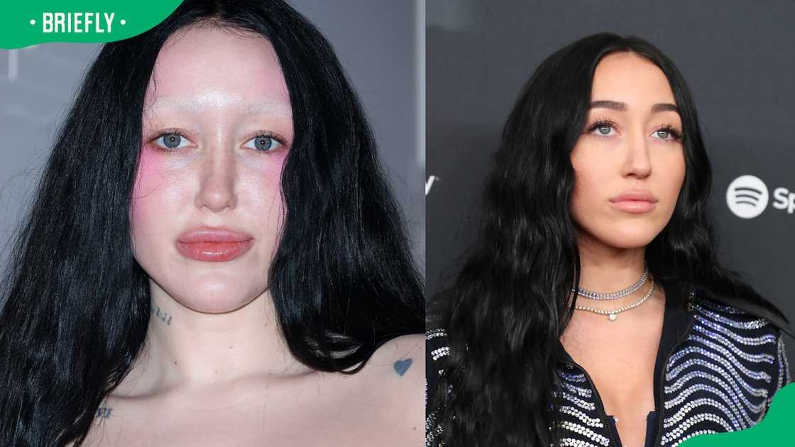 Noah Cyrus before and after photo Noah Cyrus before and after photo