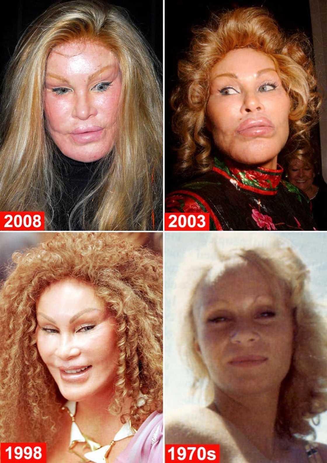 Jocelyn Wildenstein before and after surgery Jocelyn Wildenstein before and after surgery