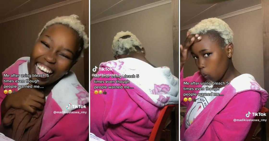 Lady bleached her hair 5 times, leaving her with bald patches where her hair used to be, TikTok video goes viral Lady bleached her hair 5 times, leaving her with bald patches where her hair used to be, TikTok video goes viral