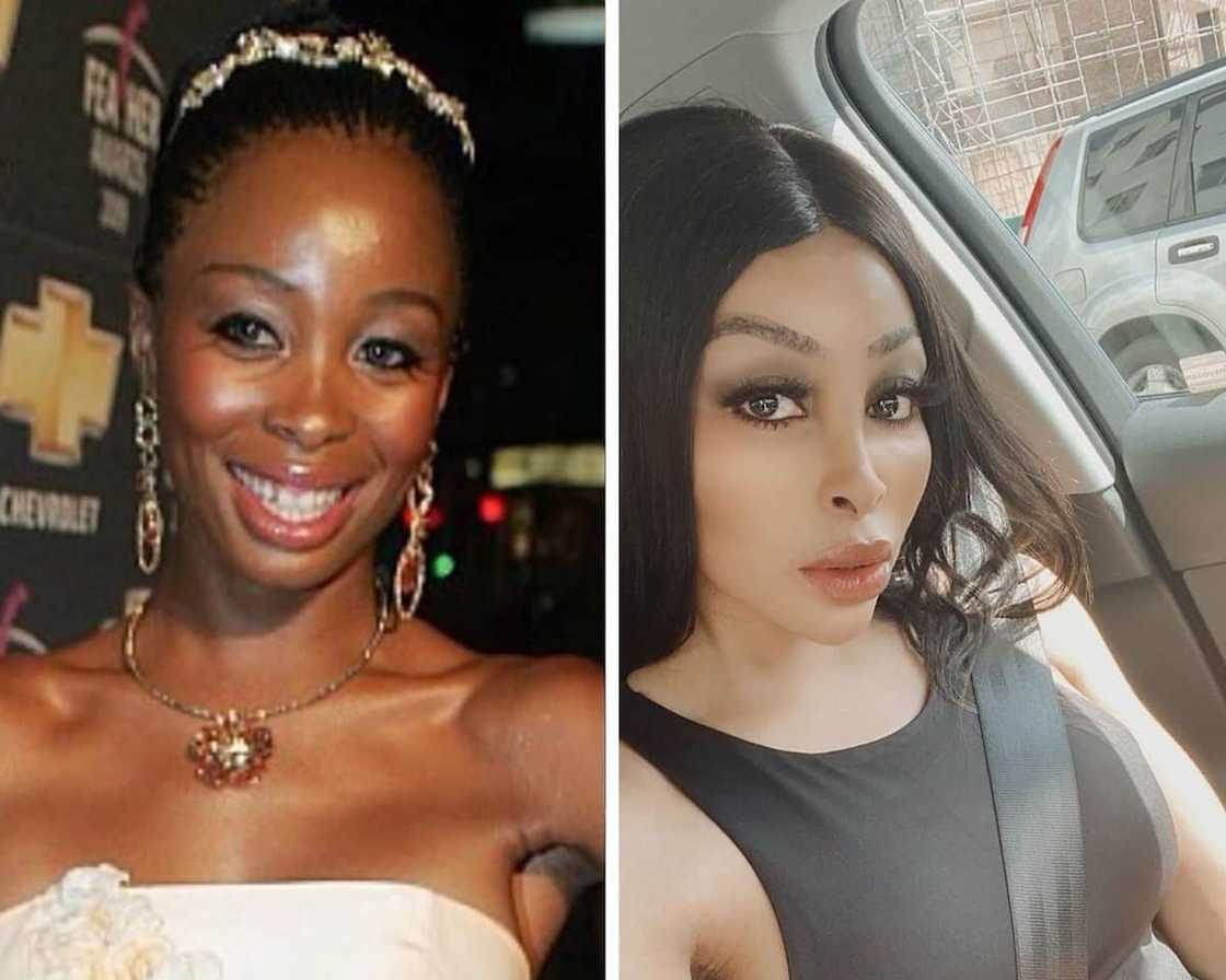 Khanyi Mbau plastic surgery photos Khanyi Mbau plastic surgery photos
