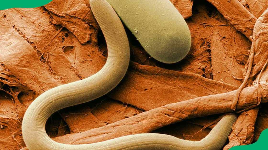 A nematode in soil A nematode in soil