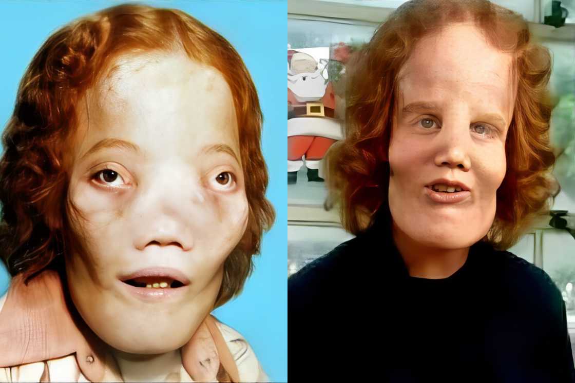 Rocky Dennis Rocky Dennis