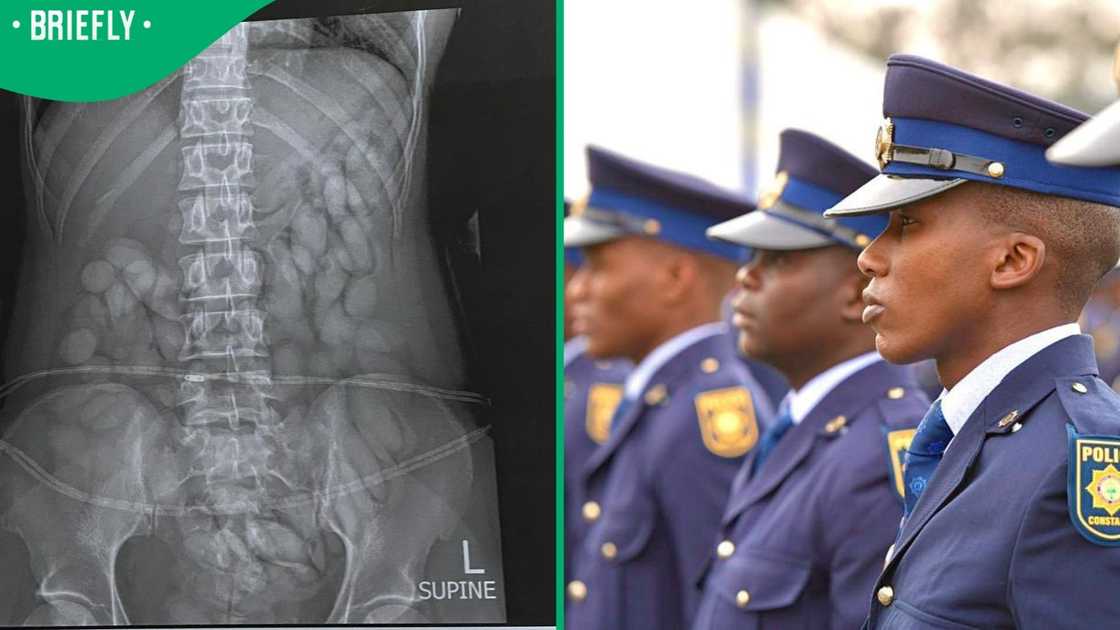 Police arrested a woman after an X-ray found that she had drugs in her stomach.