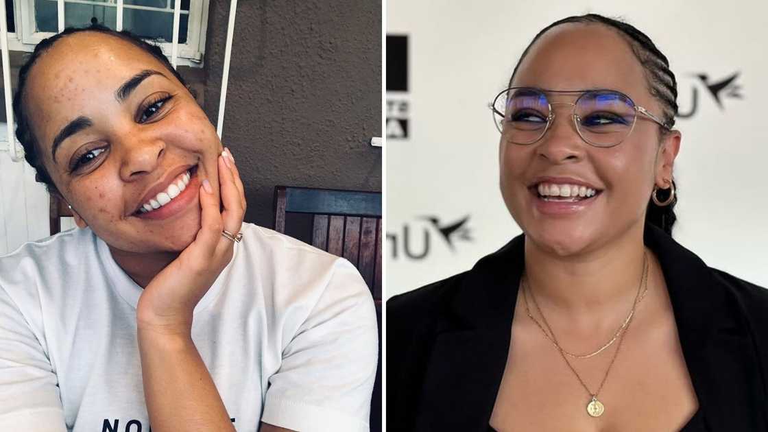 Stephanie Ndlovu opened up about her skin journey Stephanie Ndlovu opened up about her skin journey