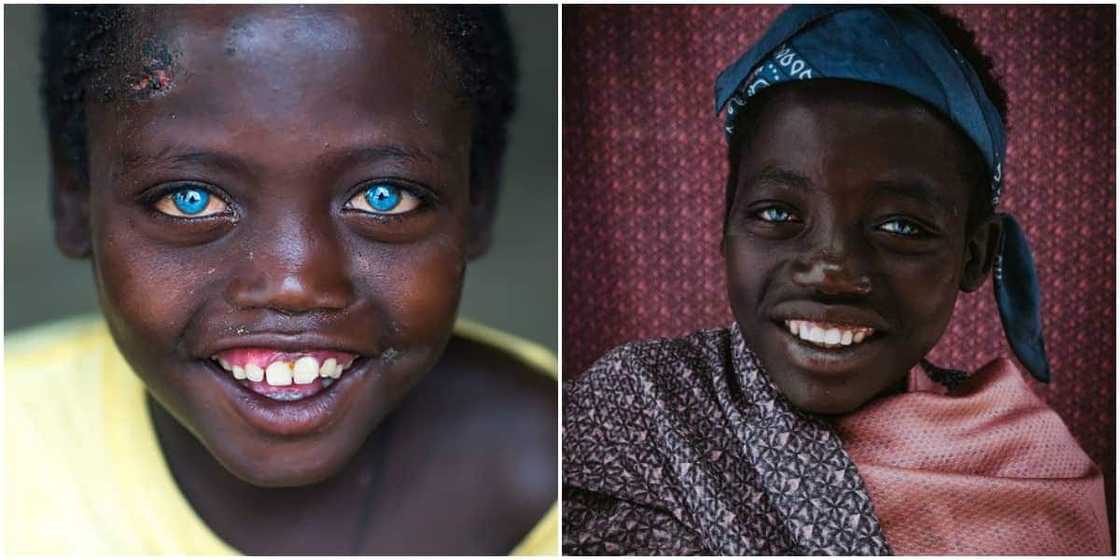 Boy with natural blue eyes said some people thought he was cursed