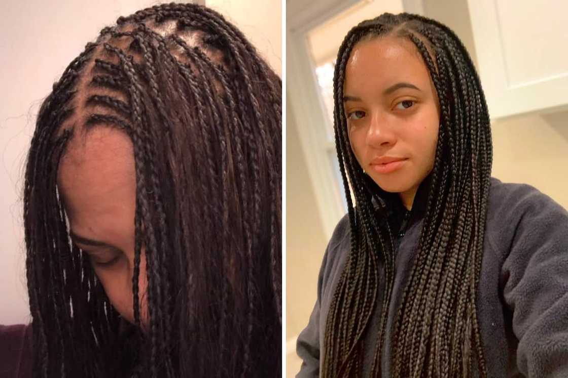 Just the scalp Just the scalp