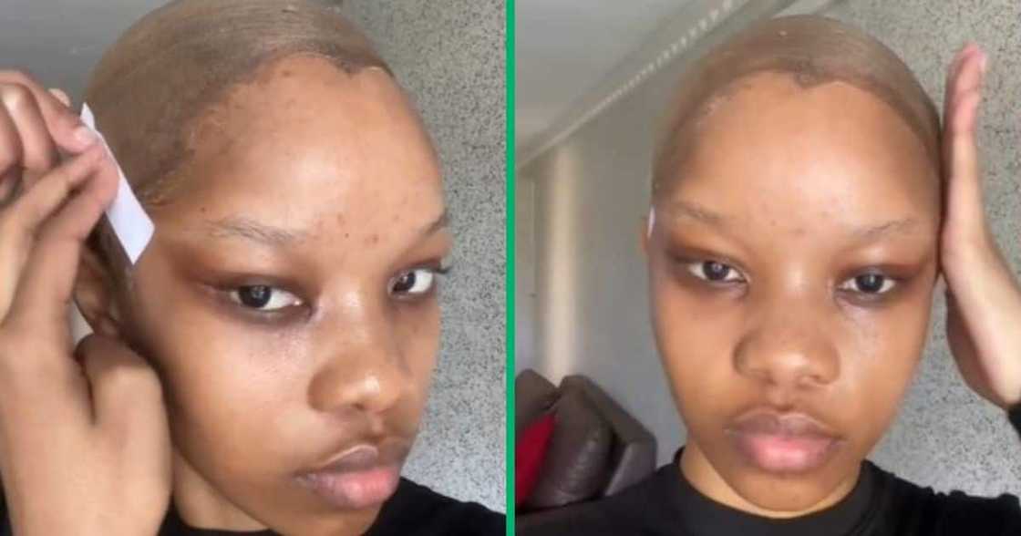 TikTok video shows woman's facelift before wig install TikTok video shows woman's facelift before wig install