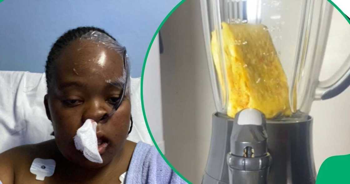 Woman recovering from double jaw surgery Woman recovering from double jaw surgery
