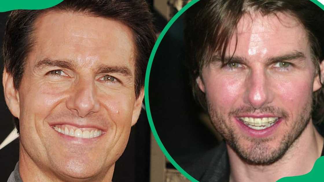 Tom Cruise wearing invincible braces at Grauman's Chinese Theatre (L). The producer attending an event at Ziegfeld Theater (R) Tom Cruise wearing invincible braces at Grauman's Chinese Theatre (L). The producer attending an event at Ziegfeld Theater (R)