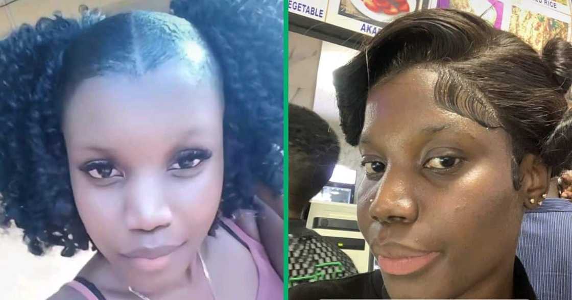 Woman shared her skin bleaching journey Woman shared her skin bleaching journey