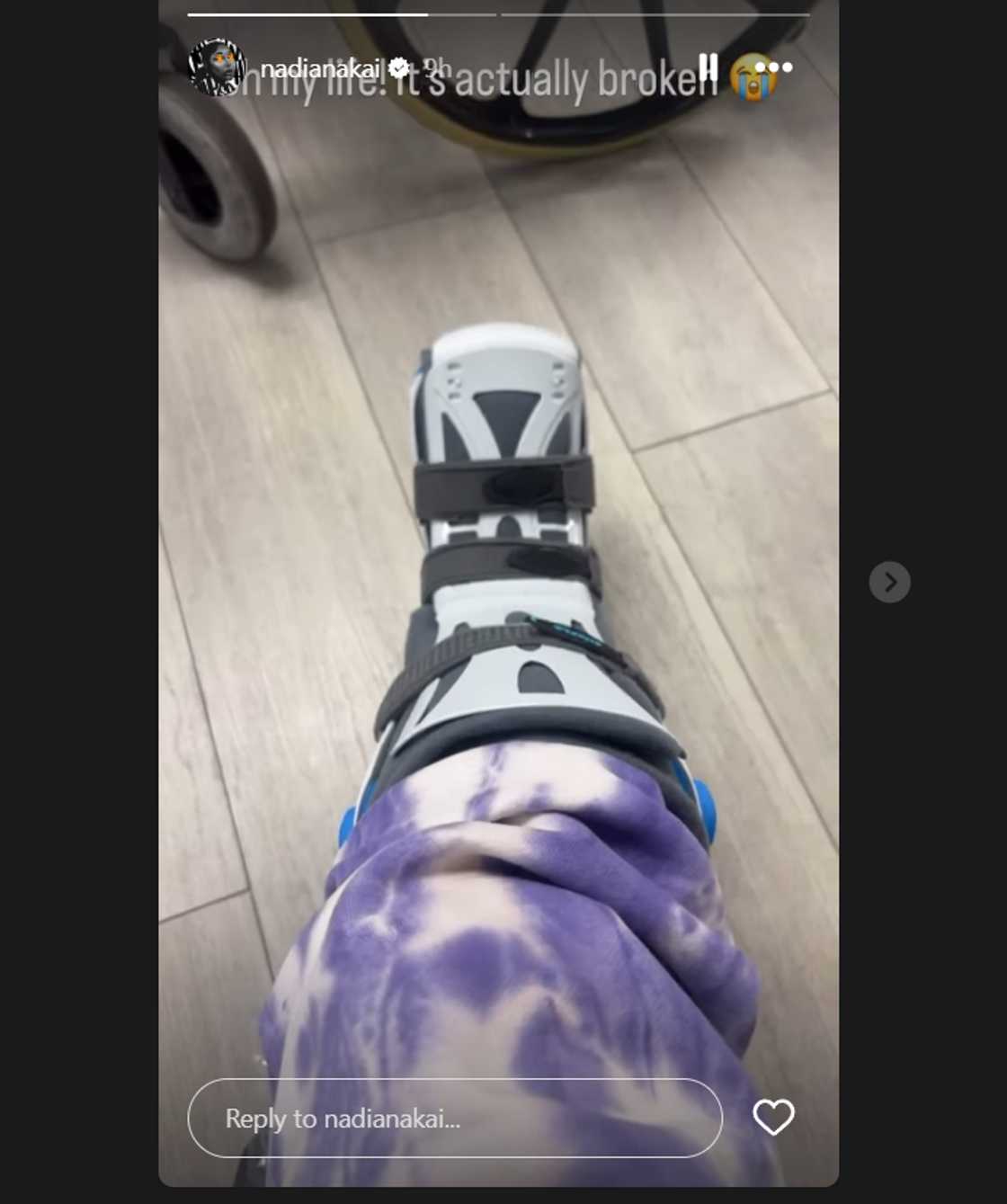 Nadia Nakai broke her leg. Nadia Nakai broke her leg.