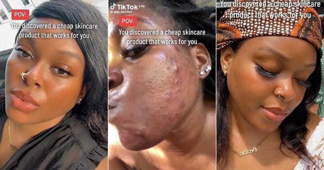 Lady's facial transformation stuns many Lady's facial transformation stuns many