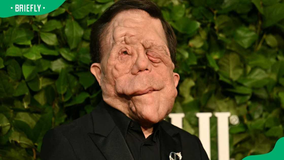 Adam Pearson during The Gothams 34th Annual Film Awards at Cipriani Wall Street in 2024 Adam Pearson during The Gothams 34th Annual Film Awards at Cipriani Wall Street in 2024
