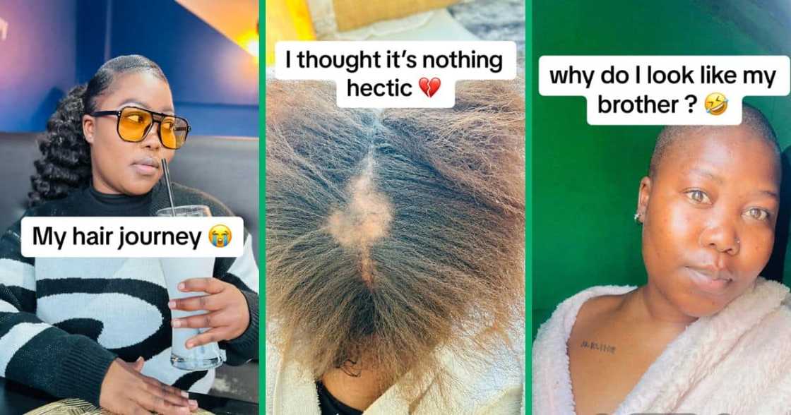 Woman opens up about hair loss journey Woman opens up about hair loss journey