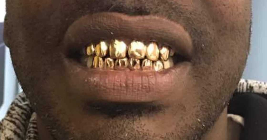 Gold teeth, dentist