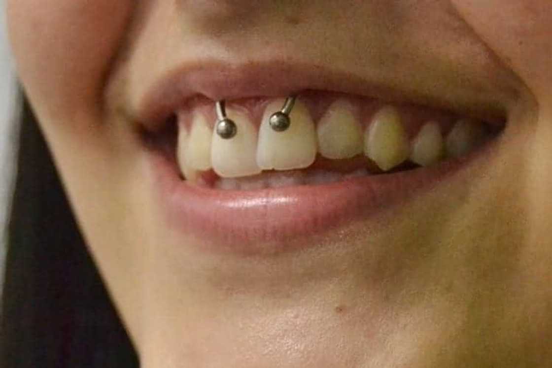 Are smiley piercings safe? Are smiley piercings safe?