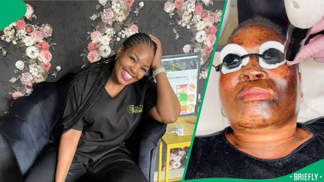 Mzansi amazed by woman's skin restoration