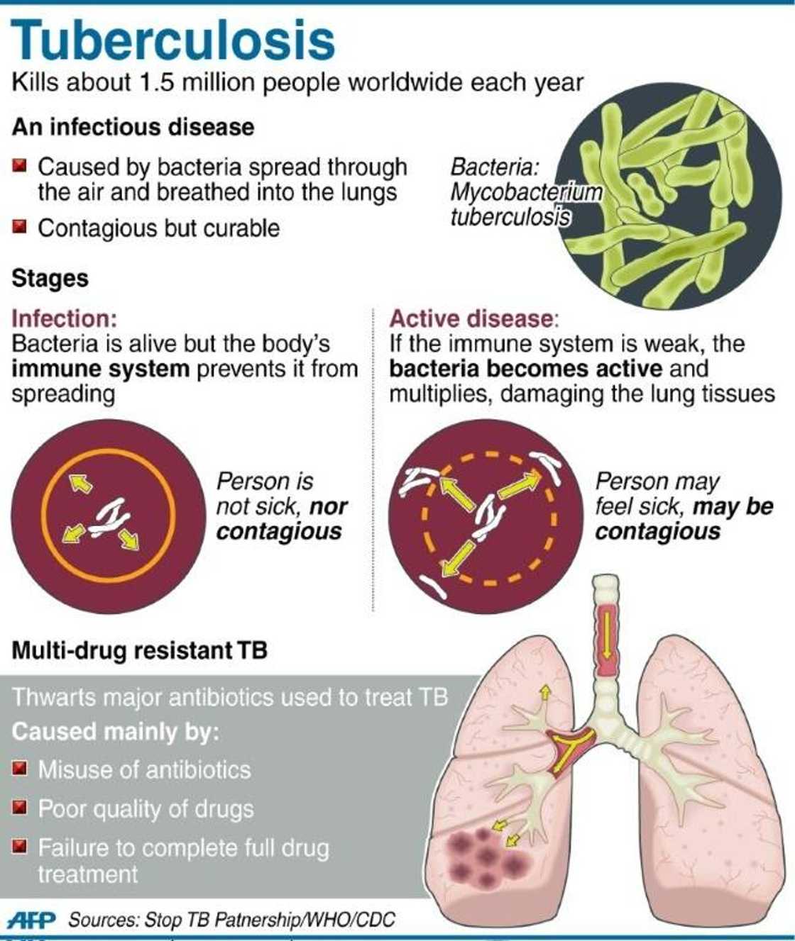 Tuberculosis Tuberculosis
