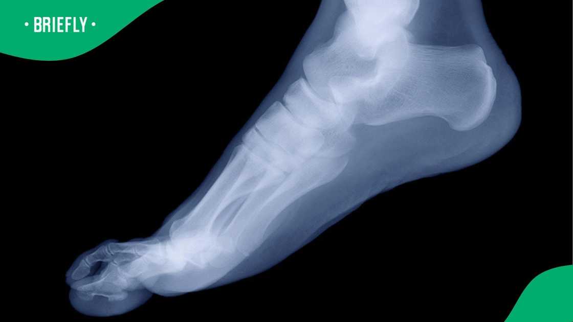 A Stock image of X-ray foot A Stock image of X-ray foot