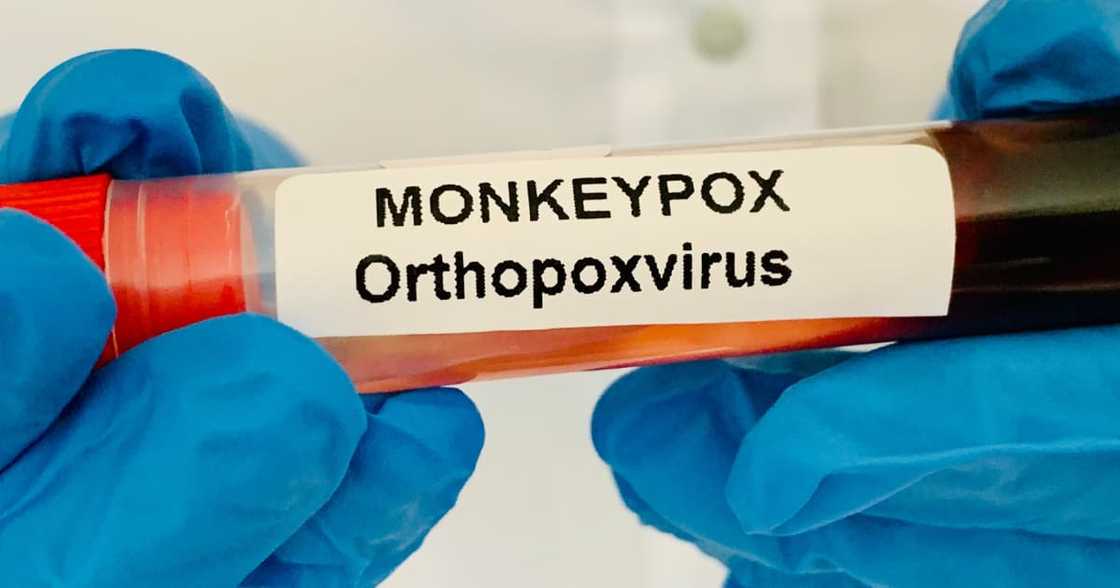 Fact check, Monkeypox, Vaids, AIDS, shingles Fact check, Monkeypox, Vaids, AIDS, shingles