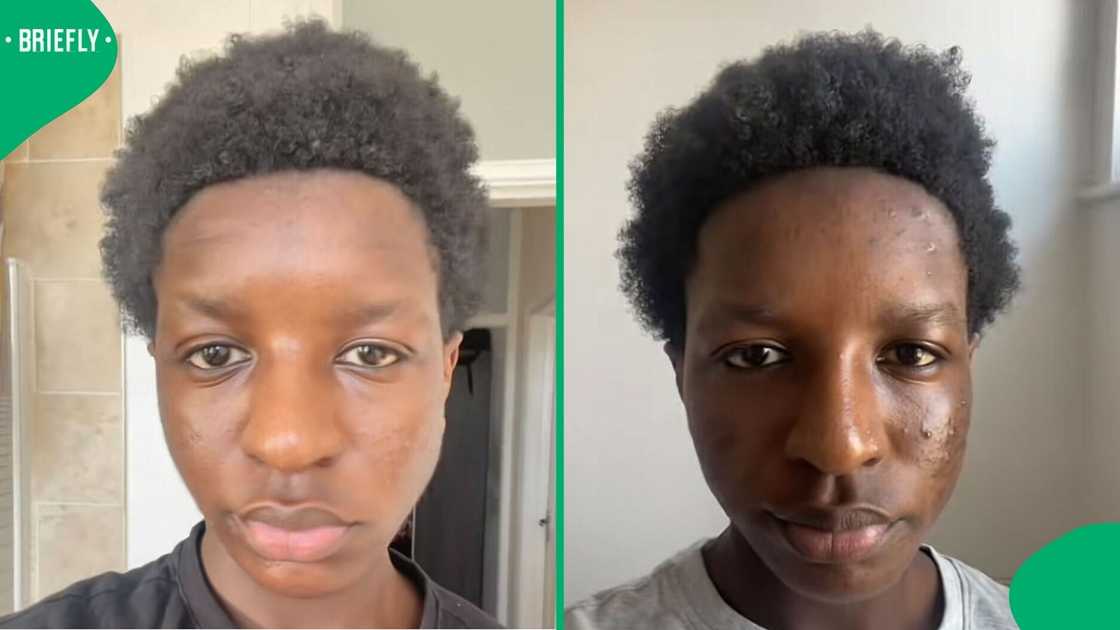 A man showcased his incredible skin glow-up in a TikTok video.