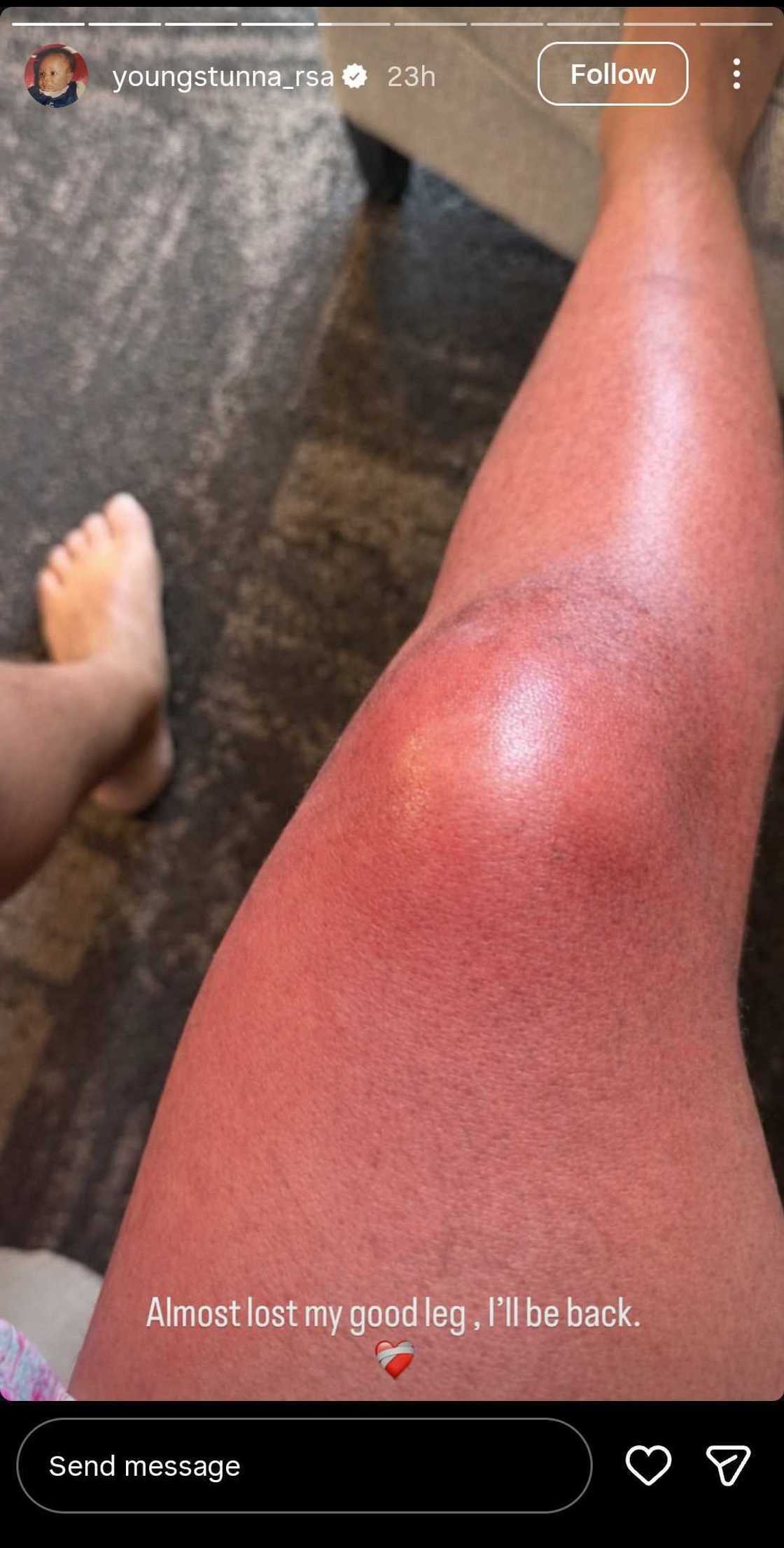 Young Stunna injured