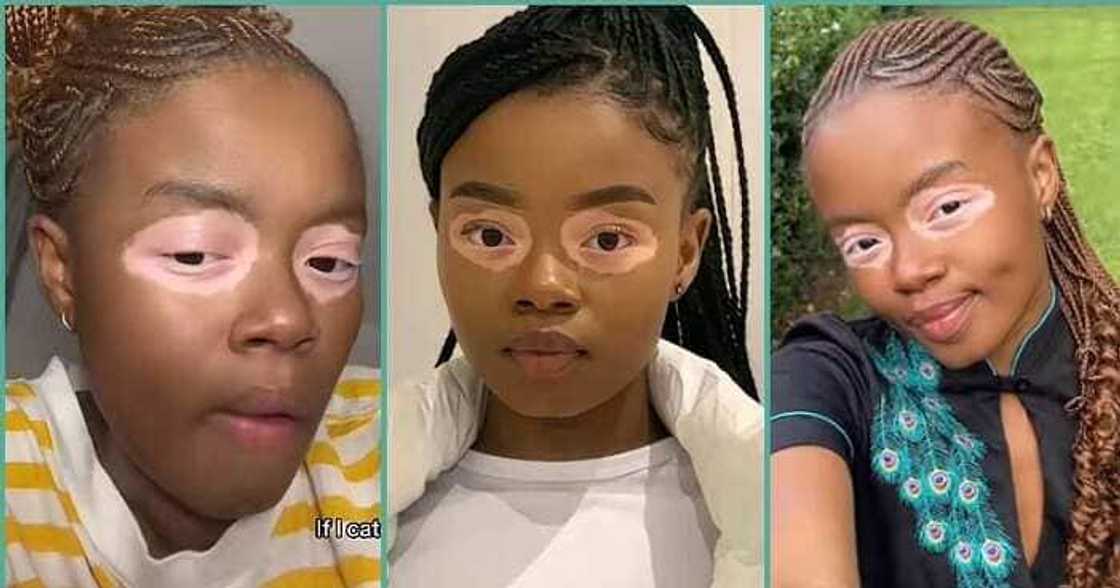 Lady flaunts her unique facial skin with shiny circle Lady flaunts her unique facial skin with shiny circle