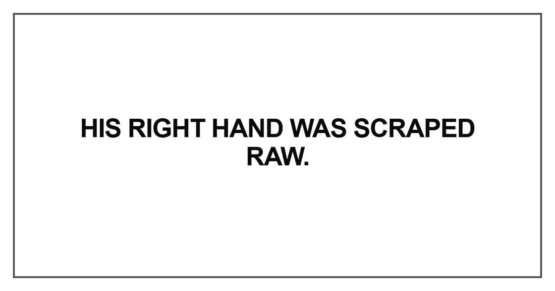 His right hand was scraped raw His right hand was scraped raw