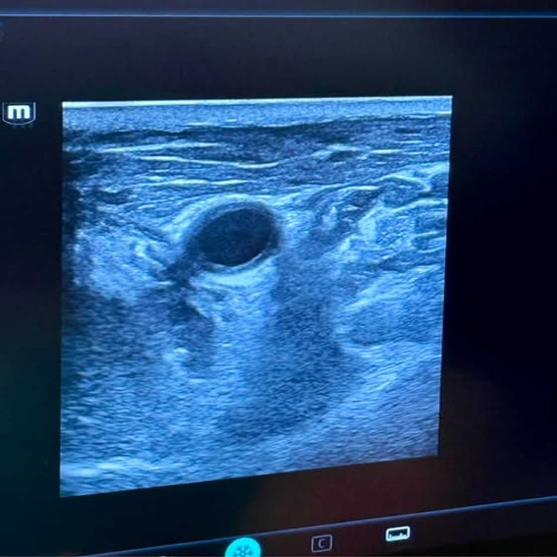 Cape Town Interventional Radiology