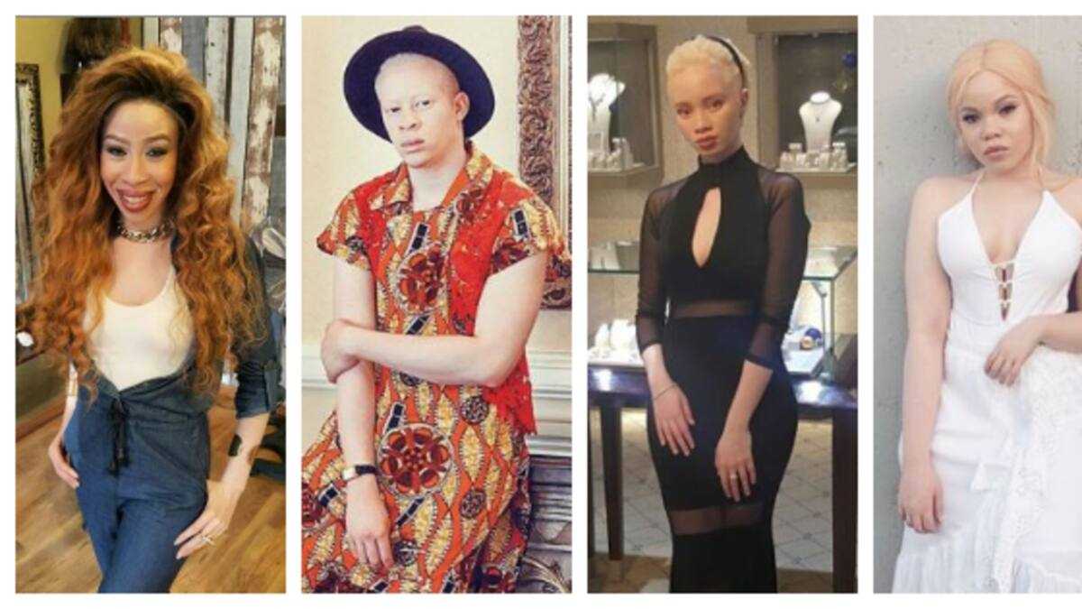 4 albino celebs in the entertainment industry who serve as inspiration -  Briefly.co.za