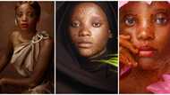 Pretty lady with a rare skin condition opens up in new video