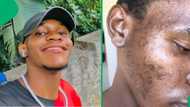 South African man's viral skincare routine for clear skin leaves Mzansi in awe