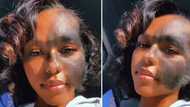 Woman with "werewolf syndrome" flaunts unique beauty in viral Insta video
