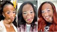 “You're so beautiful”: Pretty lady shows off her unique skin; many gush over her photo